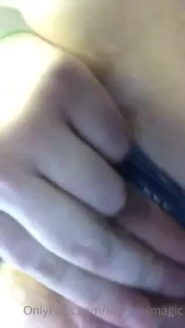 18137744