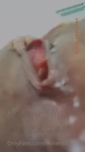 18135799