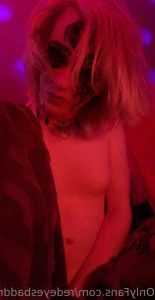 16237876