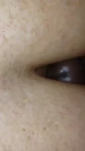 18115417