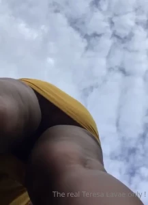15633810
