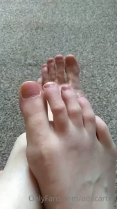 15616962