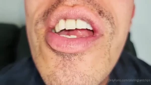 15741726