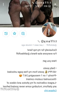 15918214