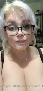 15283562