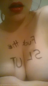 15845242