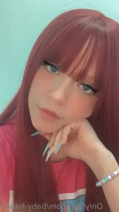 11845794