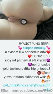 11303704