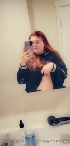 12382491