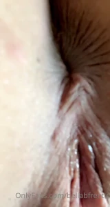 13238710