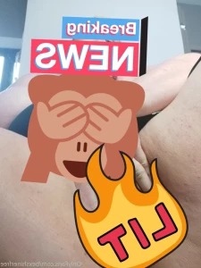 15560236