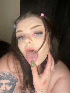 11338844
