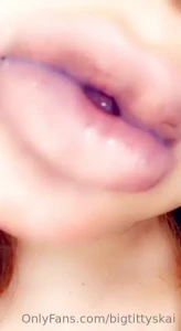 15164264
