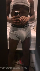 11857418