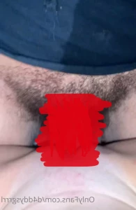 15246570