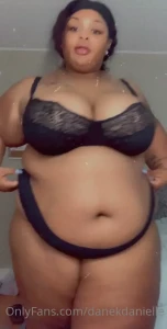 15723631