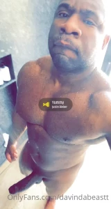 15042911