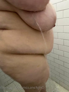 15777418