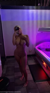 15562318