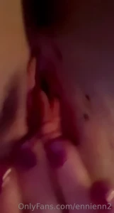 15249319