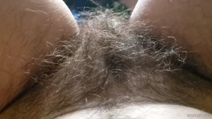 15882820