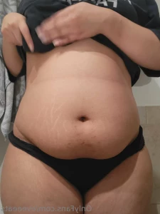 15518028