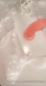 15492530