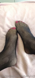 15573776