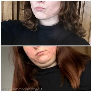 10956416