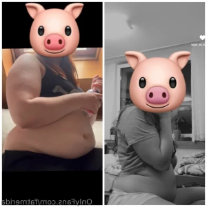 15850170