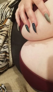 13887761