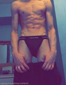 15240276
