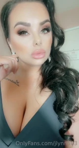 15178309