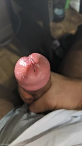 16047249