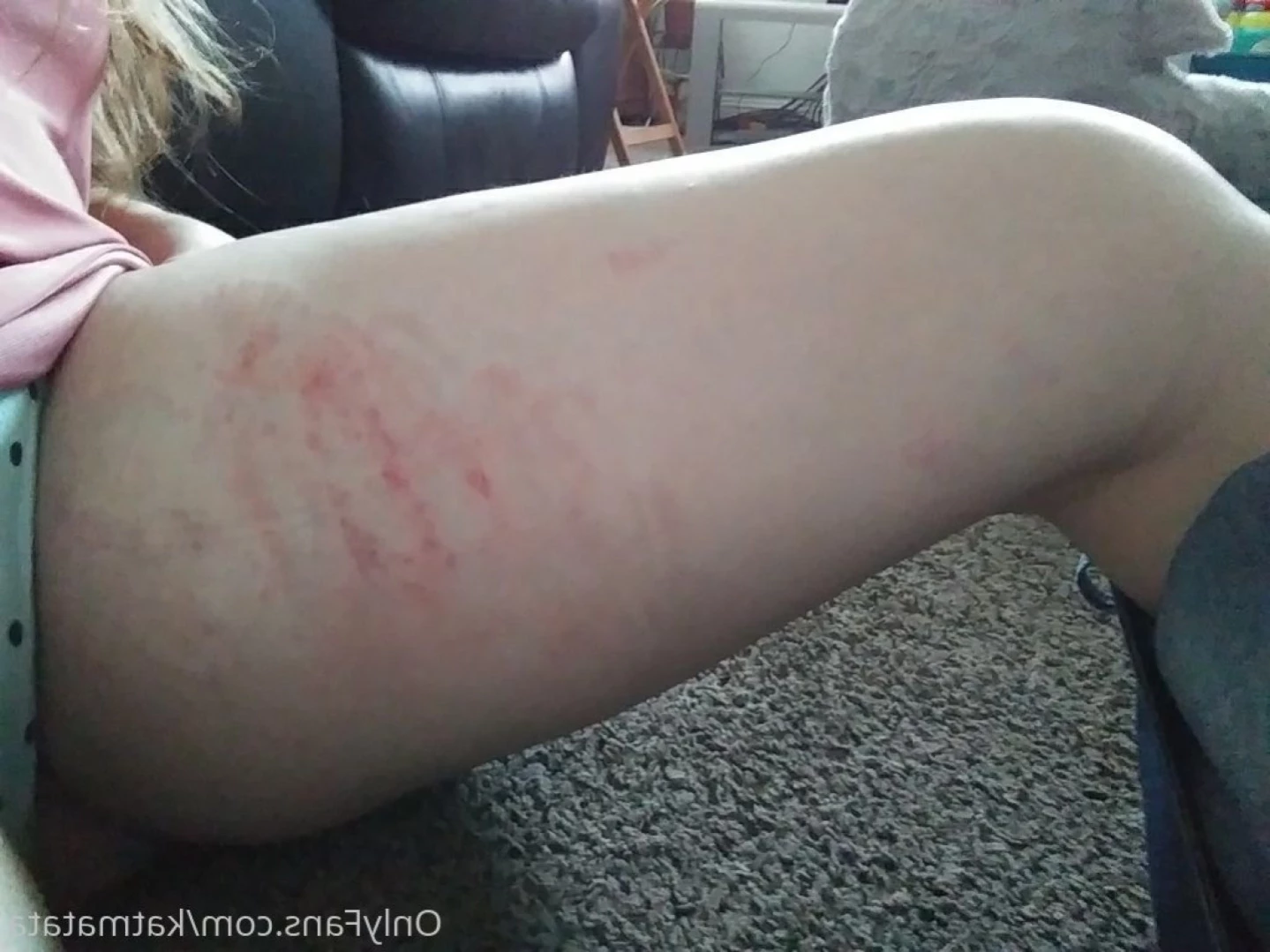 Kat [ katmatata ] Onlyfans leaked photo 11196167 on Hotleaks.tv