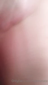 15920928