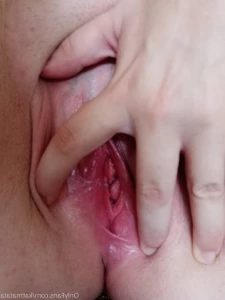 16078315