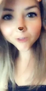 18096332