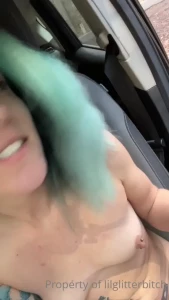 15786178