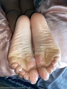 14476628