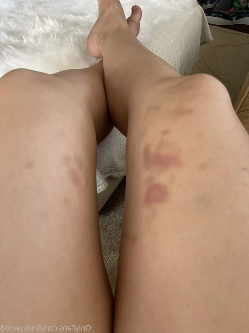 lindsy [ luluwunderful ] Onlyfans leaked photo 15206267 on Hotleaks.tv