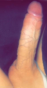15169014