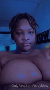 15212278