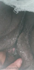 11234620