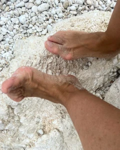 17270590