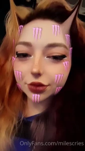 15187572