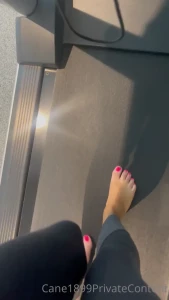 14915931
