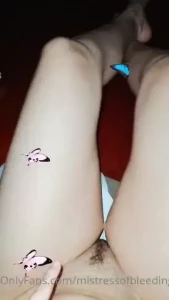 18087819