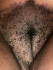 11284159