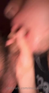 15861770